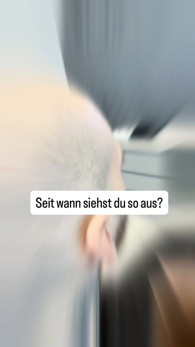 Du musst dich nicht mehr verstecken. Und du musst auch keine Kompromisse mehr eingehen. Scalp Micropigmentation ist keine…