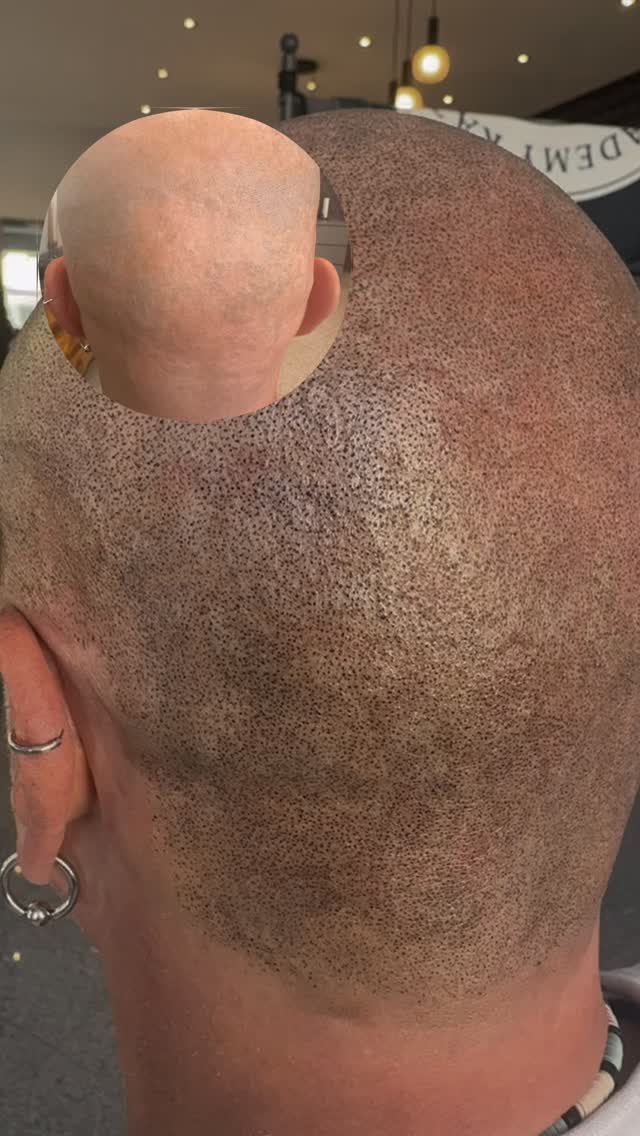 Scalp Micropigmentation SMP Nürnberg #scalpmicropigmentation #haarpigmentierung #nürnberg #scalpacademy #selbstbewusstsein
